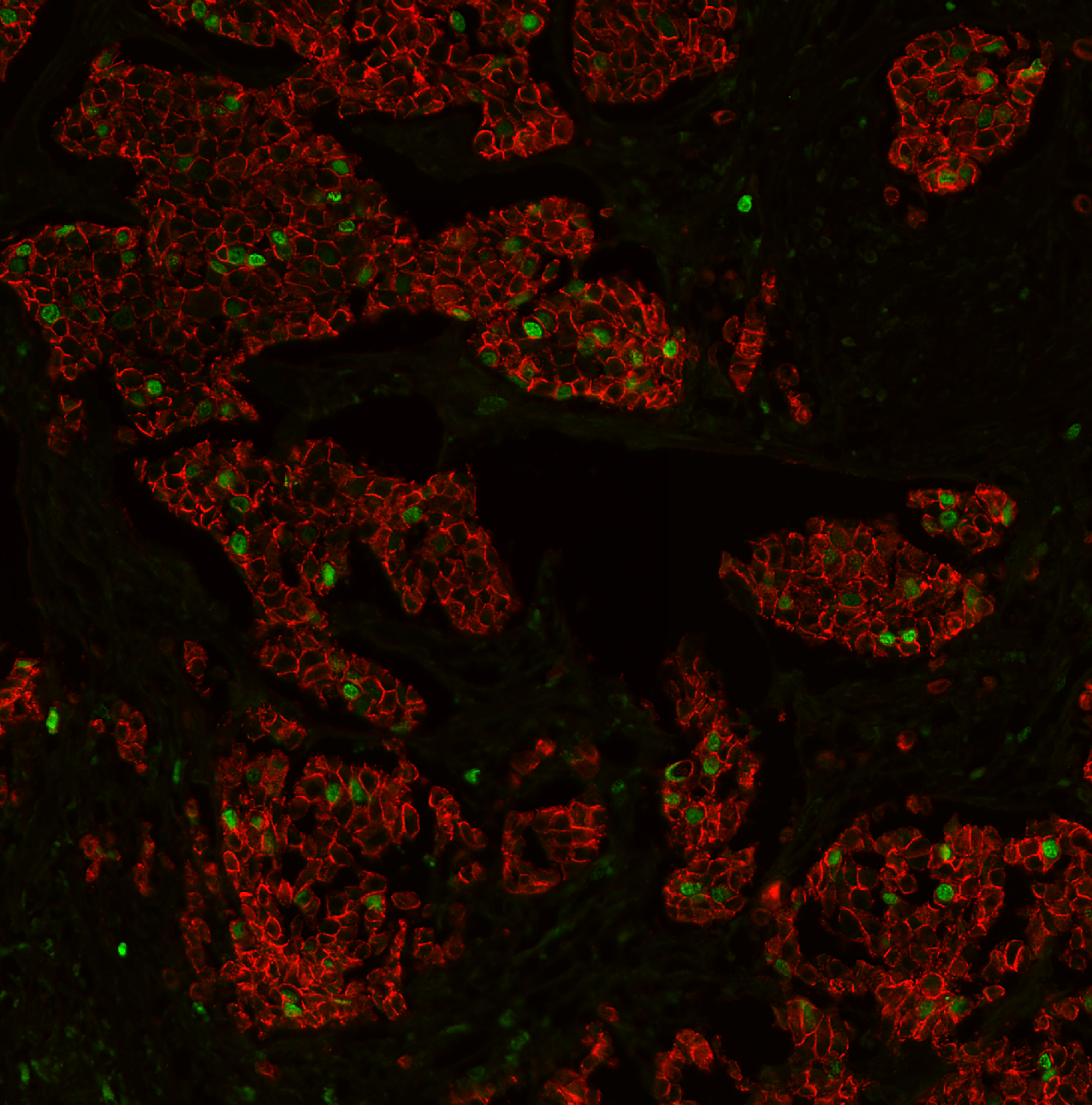 Breast training image