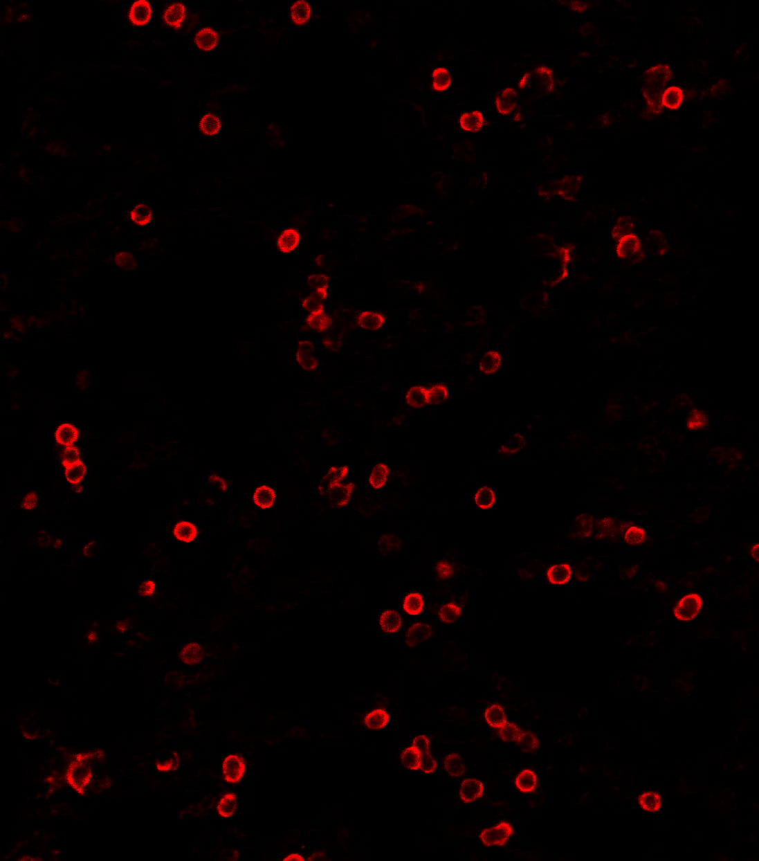 Lung crosstalk Clear output