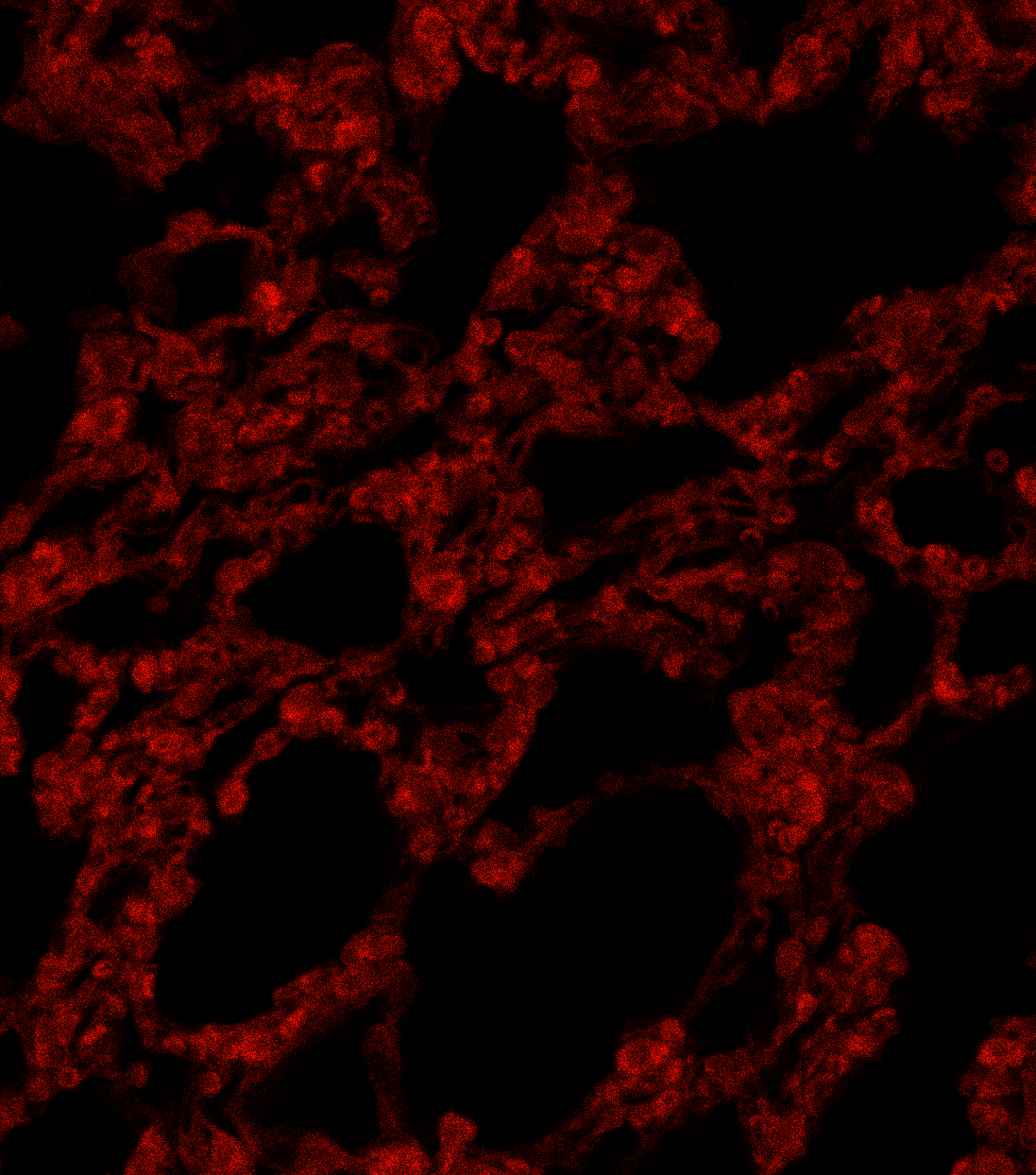 Lung crosstalk negative control