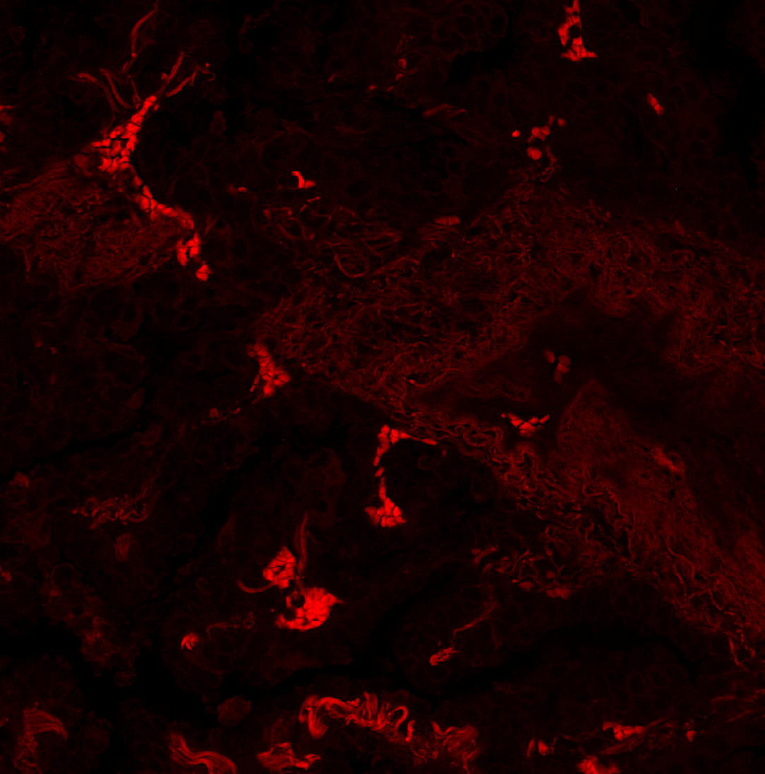 Lung negative control